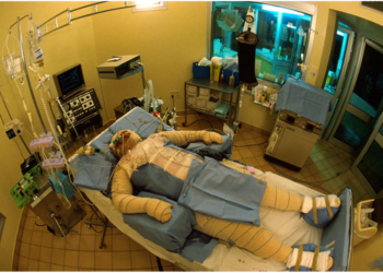 Prise en charge des grands brûlés : La vie après les flammes