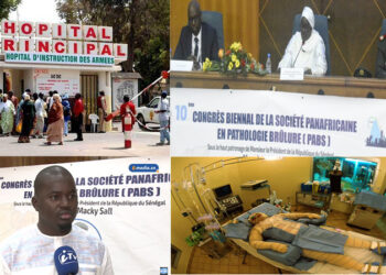 Prise en charge des grands brûlés : le point de vue d’un infirmier traitant