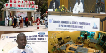 Prise en charge des grands brûlés : le point de vue d’un infirmier traitant