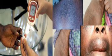 [Reportage] Mort, jambe amputée, crises… : Confessions froides de femmes (Suite) 