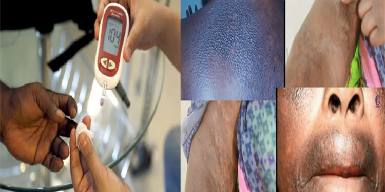 [Reportage] Mort, jambe amputée, crises… : Confessions froides de femmes (Suite) 