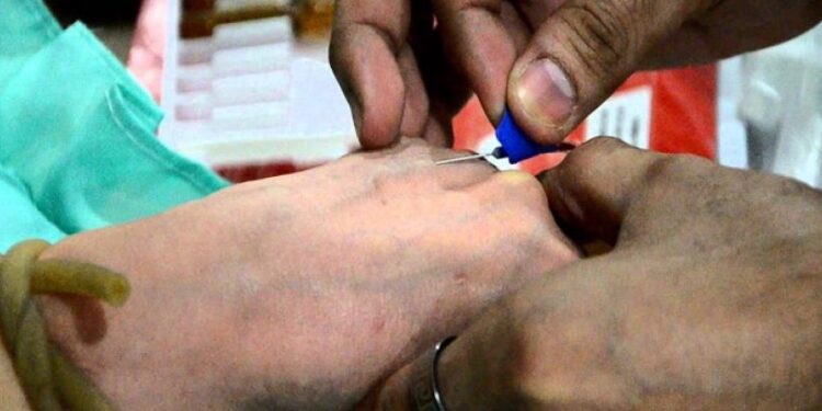 [Reportage-Suite] Dans l’intimité des accros à l’intraveineuse : « Par peur de se tailler la peau, elle ne fait plus linge » 