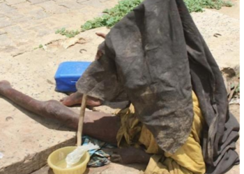 [Dossier] Le Centre de l’assistance aux malades mentaux errants au Sénégal : Personne ne se perd, tout se soigne !