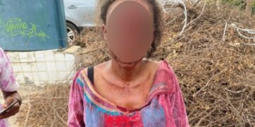 Ministère de la santé : Une femme et son bébé sauvagement battus par un vigile 