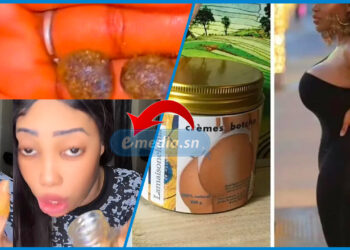 Pommades pour fesses et produits dangereux : la police démantèle un vaste réseau au marché Zinc