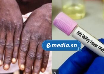 Le Sénégal face à deux épidémies : la Mpox à Dakar et la Fièvre de la Vallée du Rift à Saint-Louis 4 InCollage 20250930 085209921