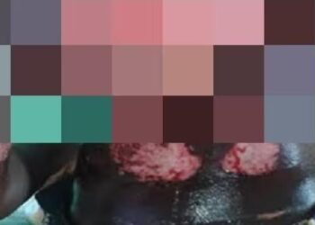 Crise de jalousie à Touba : une femme ébouillante son mari pour une histoire de niarél<br> 2 IMG 20251027 WA0033