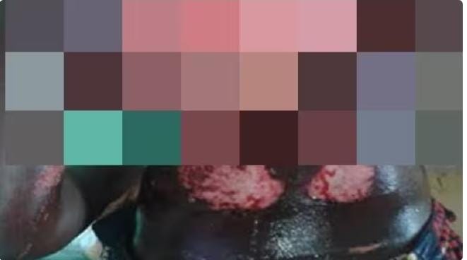 Crise de jalousie à Touba : une femme ébouillante son mari pour une histoire de niarél<br> 1 IMG 20251027 WA0033
