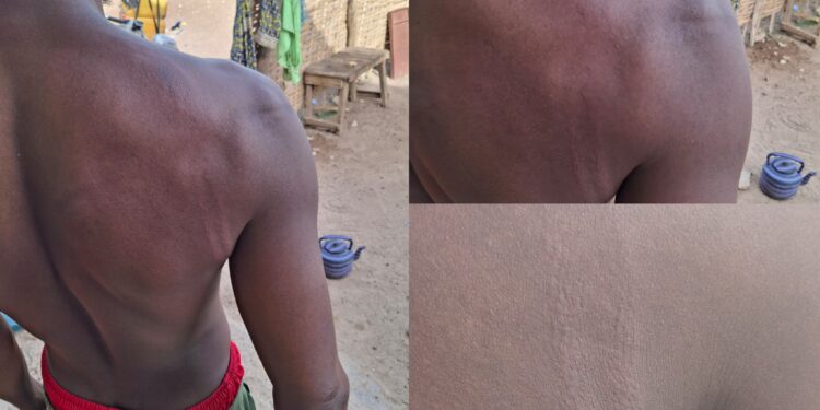 Tambacounda : un directeur d’école élémentaire agressé par un agent du GARSI à Diyabougou‎